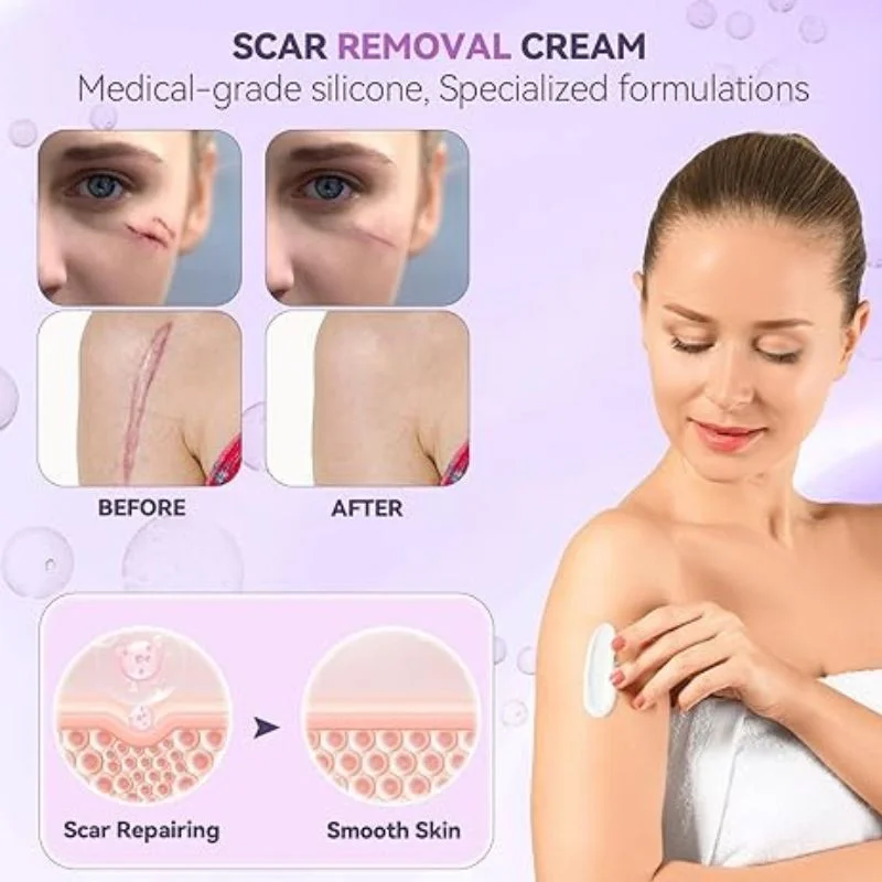 TIMILK Scarvanisher Scar Gel 30g - Image 3