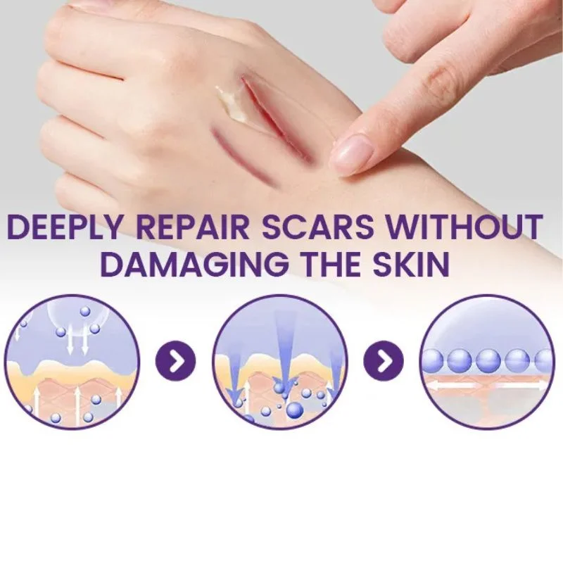 TIMILK Scarvanisher Scar Gel 30g - Image 2